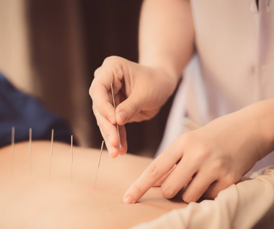 Acupunturistas